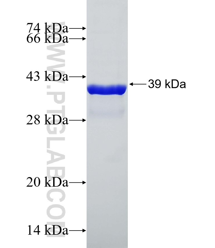 DDAH1 fusion protein Ag32516 SDS-PAGE