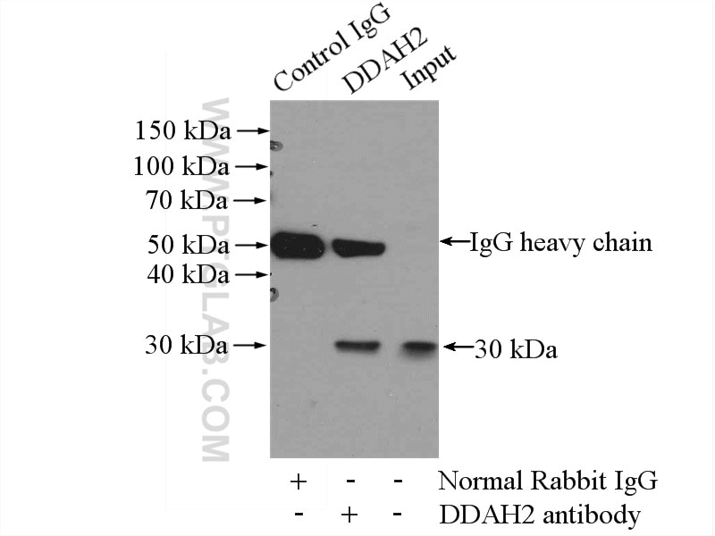 Immunoprecipitation (IP) experiment of COLO 320 cells using DDAH2 Polyclonal antibody (14966-1-AP)