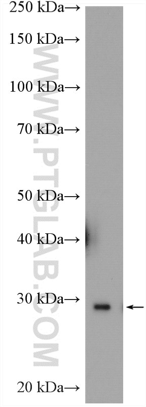 Western Blot (WB) analysis of COLO 320 cells using DDAH2 Polyclonal antibody (14966-1-AP)