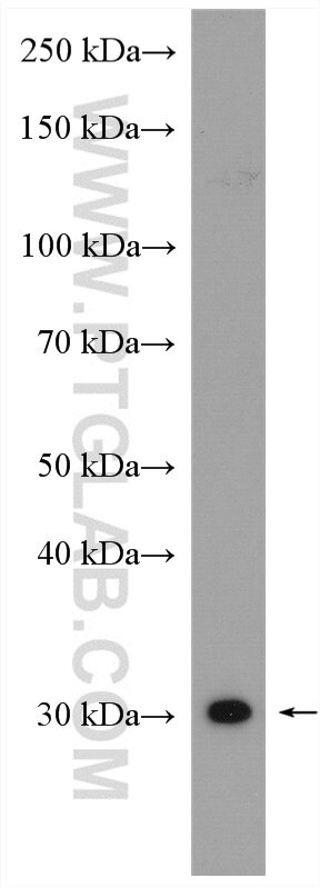 WB analysis of mouse colon using 14966-1-AP