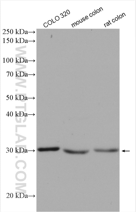 Western Blot (WB) analysis of various lysates using DDAH2 Polyclonal antibody (14966-1-AP)