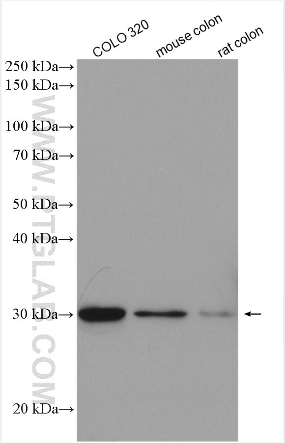 Western Blot (WB) analysis of various lysates using DDAH2 Polyclonal antibody (14966-1-AP)