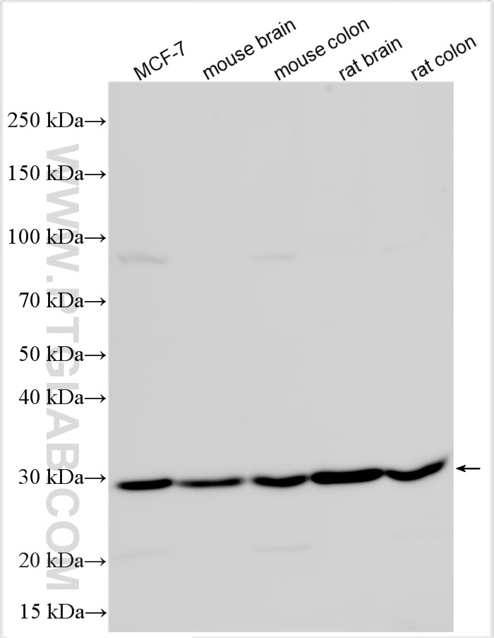 Western Blot (WB) analysis of various lysates using DDAH2 Polyclonal antibody (14966-1-AP)