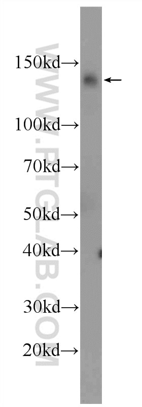 Western Blot (WB) analysis of rat testis tissue using DDB1 Polyclonal antibody (11380-1-AP)