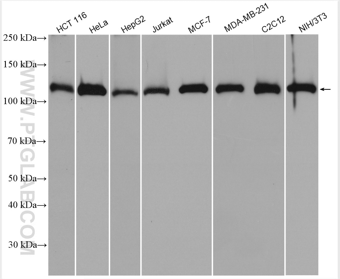 Western Blot (WB) analysis of various lysates using DDB1 Polyclonal antibody (11380-1-AP)