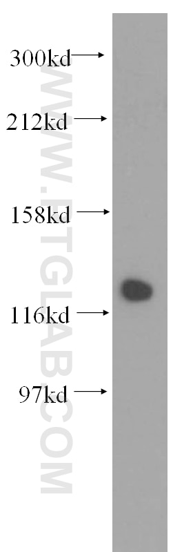 Western Blot (WB) analysis of mouse testis tissue using DDB1 Polyclonal antibody (11380-1-AP)