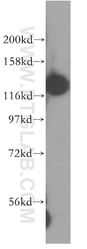 Western Blot (WB) analysis of human kidney tissue using DDB1 Polyclonal antibody (11380-1-AP)