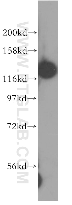 WB analysis of human kidney using 11380-1-AP