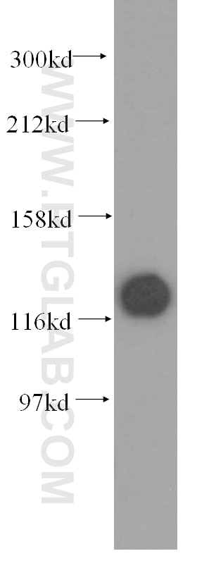 Western Blot (WB) analysis of human placenta tissue using DDB1 Polyclonal antibody (11380-1-AP)