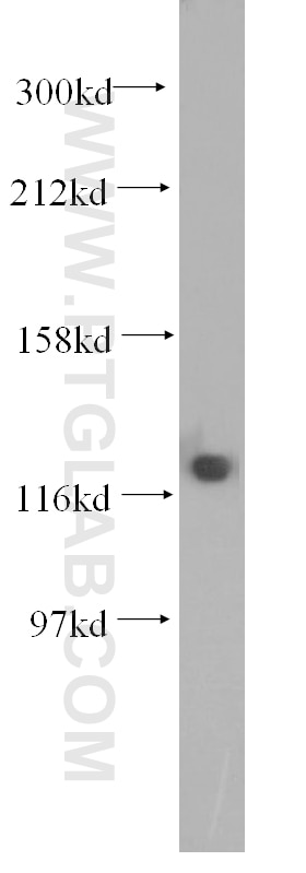 Western Blot (WB) analysis of human brain tissue using DDB1 Polyclonal antibody (11380-1-AP)