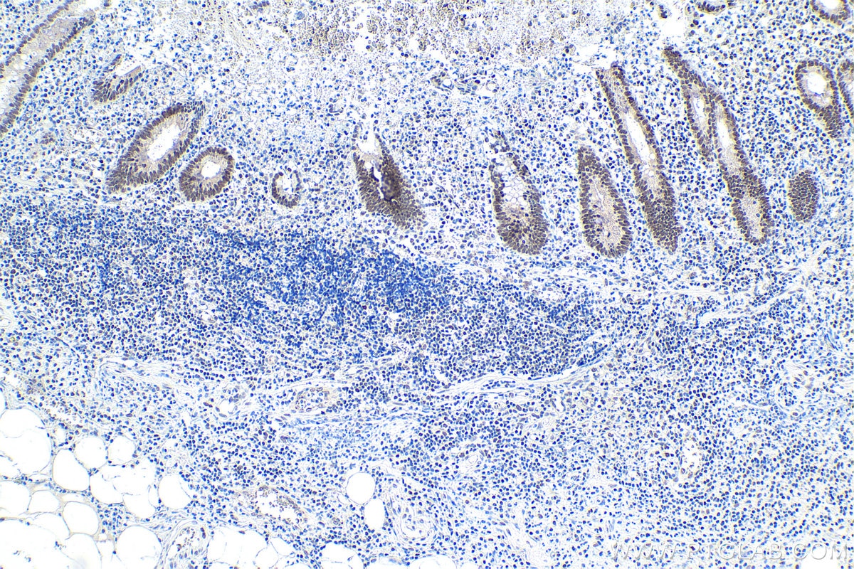 Immunohistochemistry (IHC) staining of human appendicitis tissue using DDB1 Monoclonal antibody (66010-1-Ig)
