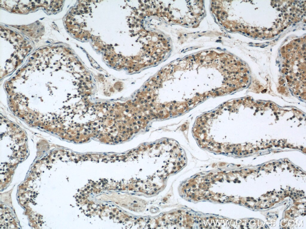 Immunohistochemistry (IHC) staining of human testis tissue using DDB1 Monoclonal antibody (66010-1-Ig)