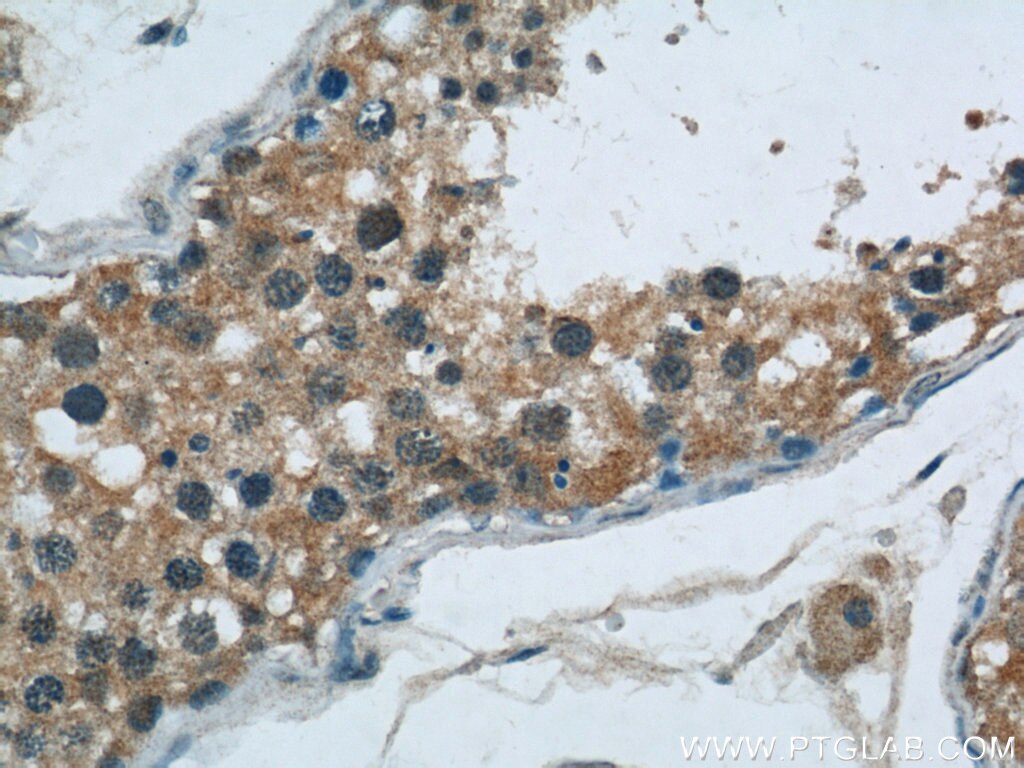 Immunohistochemistry (IHC) staining of human testis tissue using DDB1 Monoclonal antibody (66010-1-Ig)