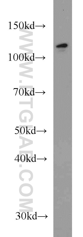 Western Blot (WB) analysis of A549 cells using DDB1 Monoclonal antibody (66010-1-Ig)