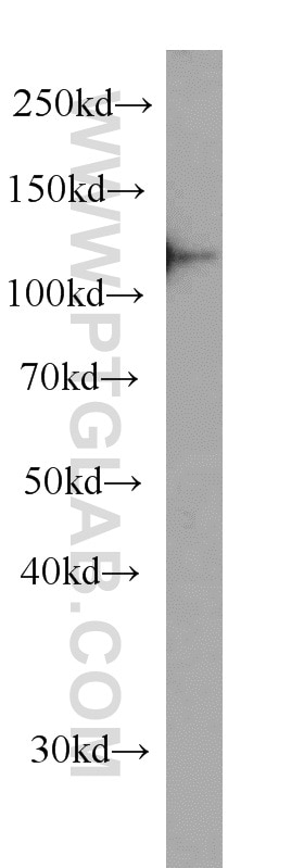 Western Blot (WB) analysis of MCF-7 cells using DDB1 Monoclonal antibody (66010-1-Ig)