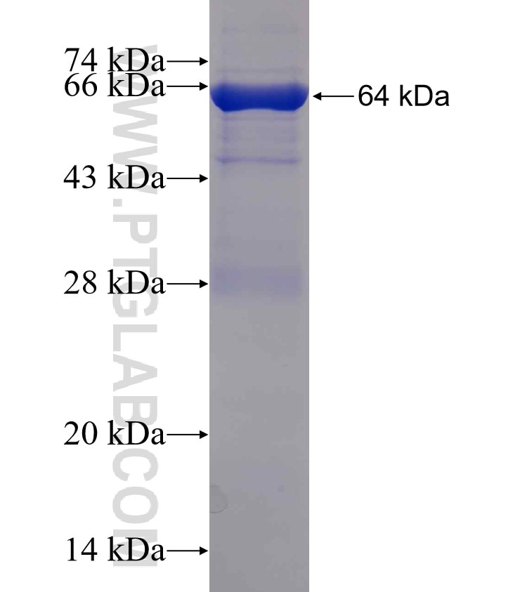 DDB1 fusion protein Ag1901 SDS-PAGE