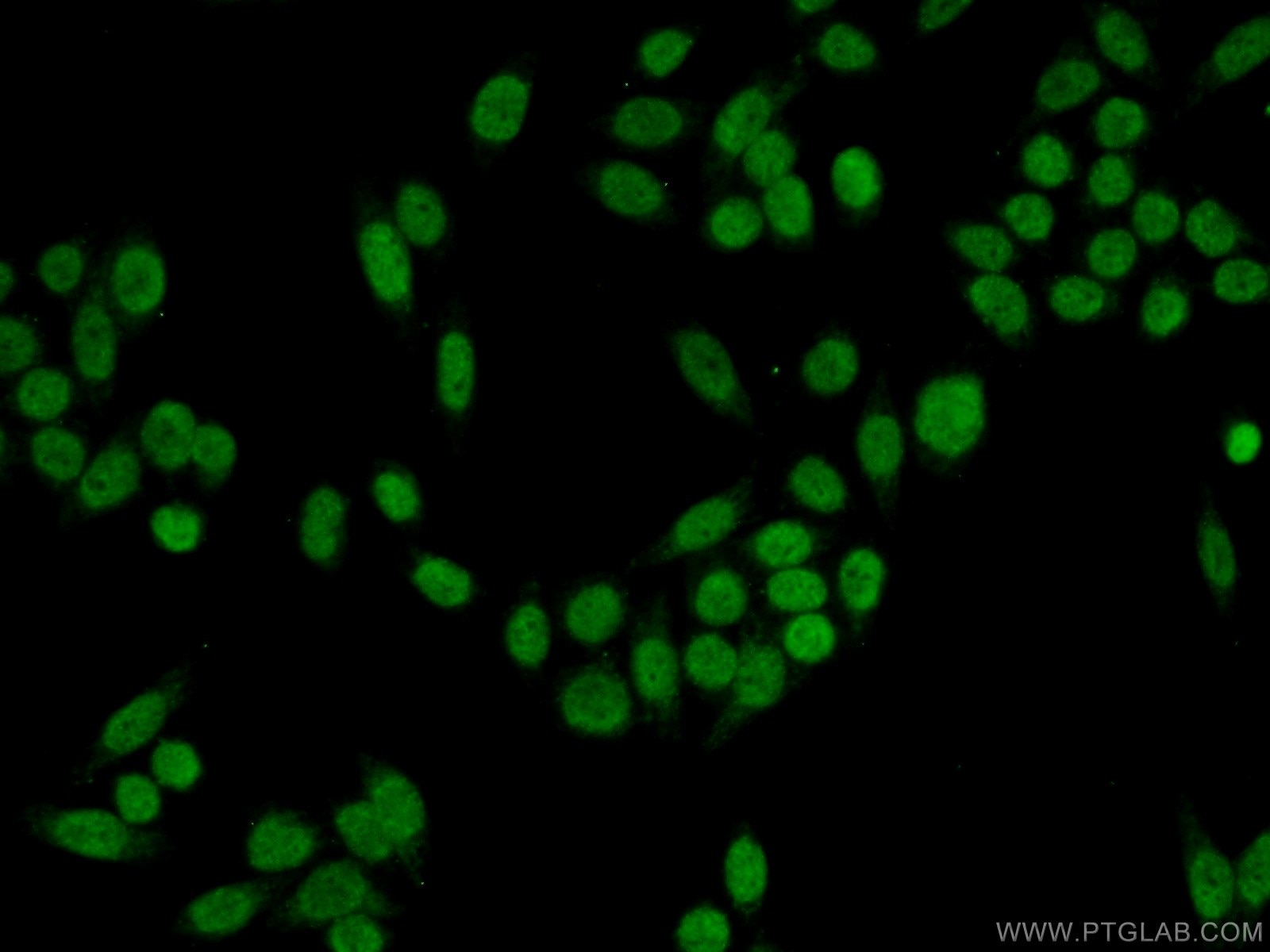 IF Staining of HeLa using 10431-1-AP
