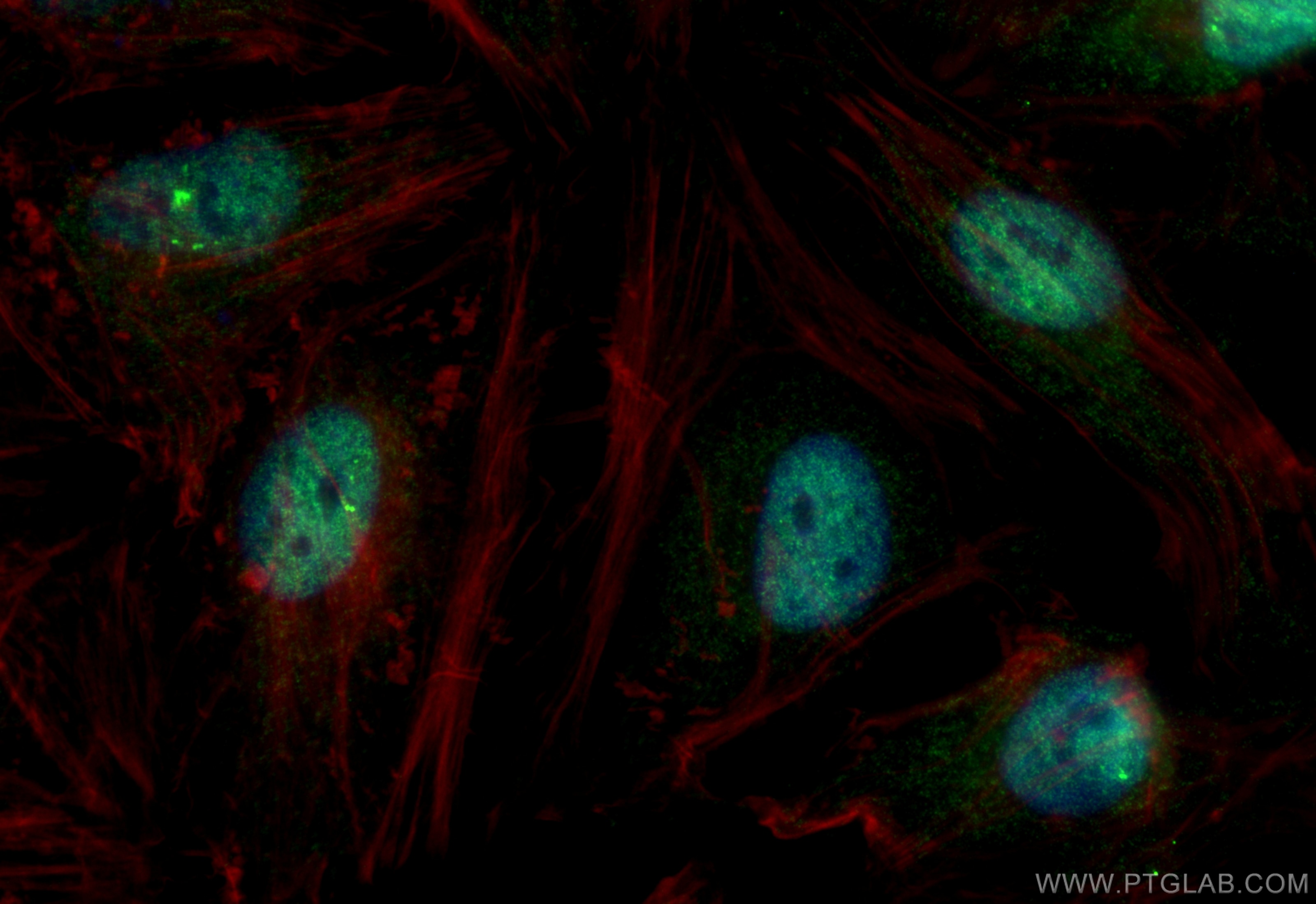 Immunofluorescence (IF) / fluorescent staining of HeLa cells using DDB2 Polyclonal antibody (10431-1-AP)