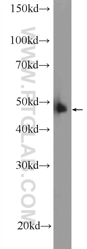 WB analysis of HeLa using 10431-1-AP