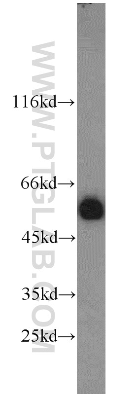 DDB2 Polyclonal antibody