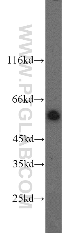 Western Blot (WB) analysis of A431 cells using DDB2 Polyclonal antibody (10431-1-AP)