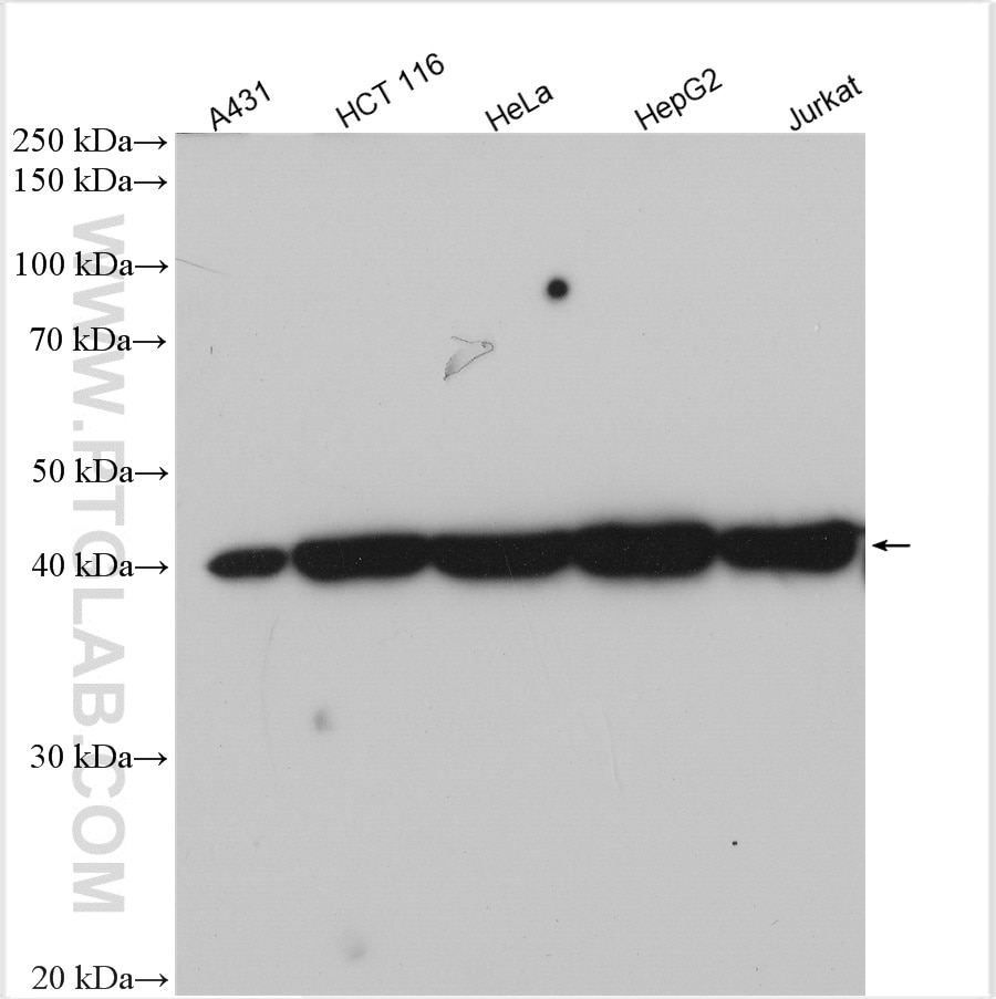 Western Blot (WB) analysis of various lysates using DDB2 Polyclonal antibody (30173-1-AP)
