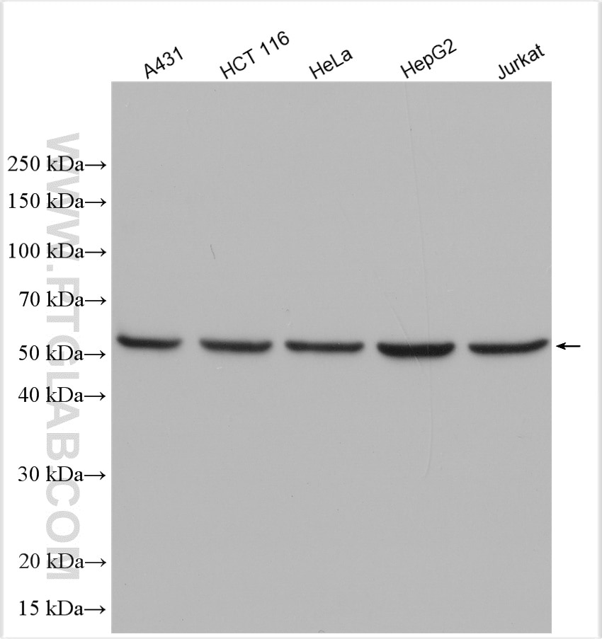 Western Blot (WB) analysis of various lysates using DDB2 Polyclonal antibody (30173-1-AP)