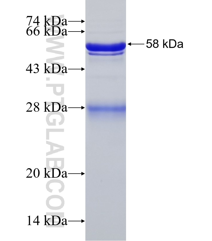 DDB2 fusion protein Ag32811 SDS-PAGE