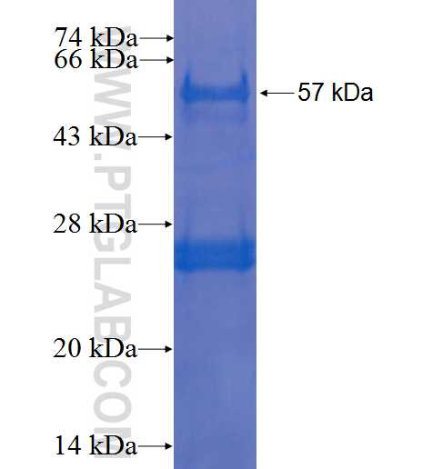 DDB2 fusion protein Ag0691 SDS-PAGE