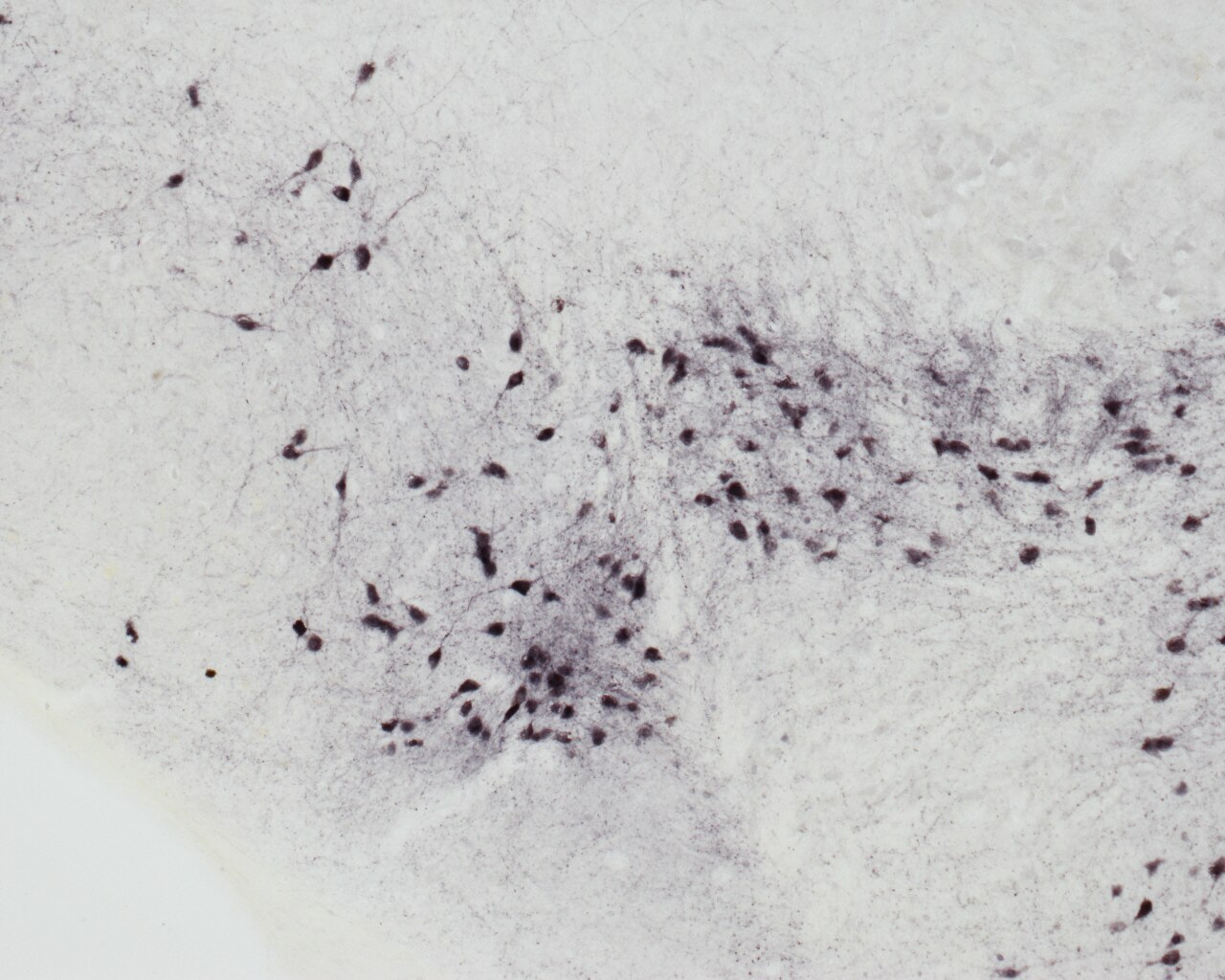 IHC staining of mouse brain using 10166-1-AP
