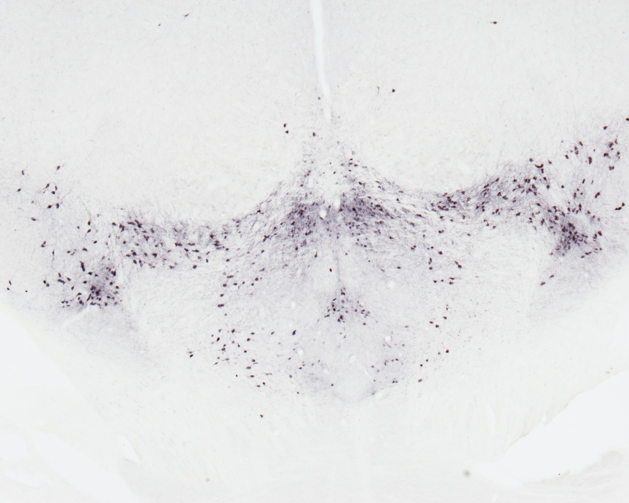 IHC staining of mouse brain using 10166-1-AP