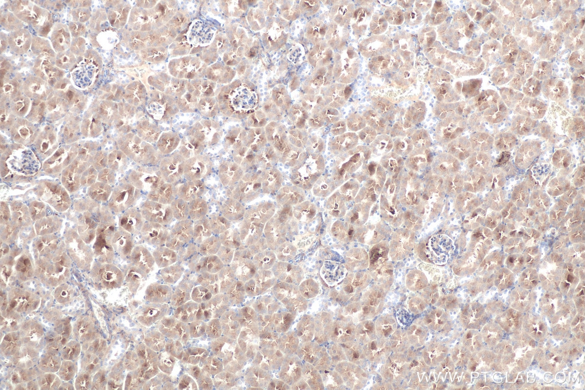Immunohistochemistry (IHC) staining of mouse kidney tissue using DOPA decarboxylase Polyclonal antibody (10166-1-AP)