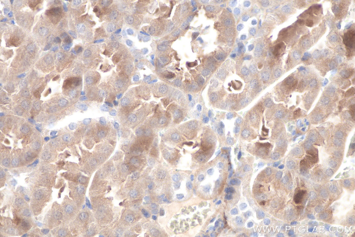 Immunohistochemistry (IHC) staining of mouse kidney tissue using DOPA decarboxylase Polyclonal antibody (10166-1-AP)