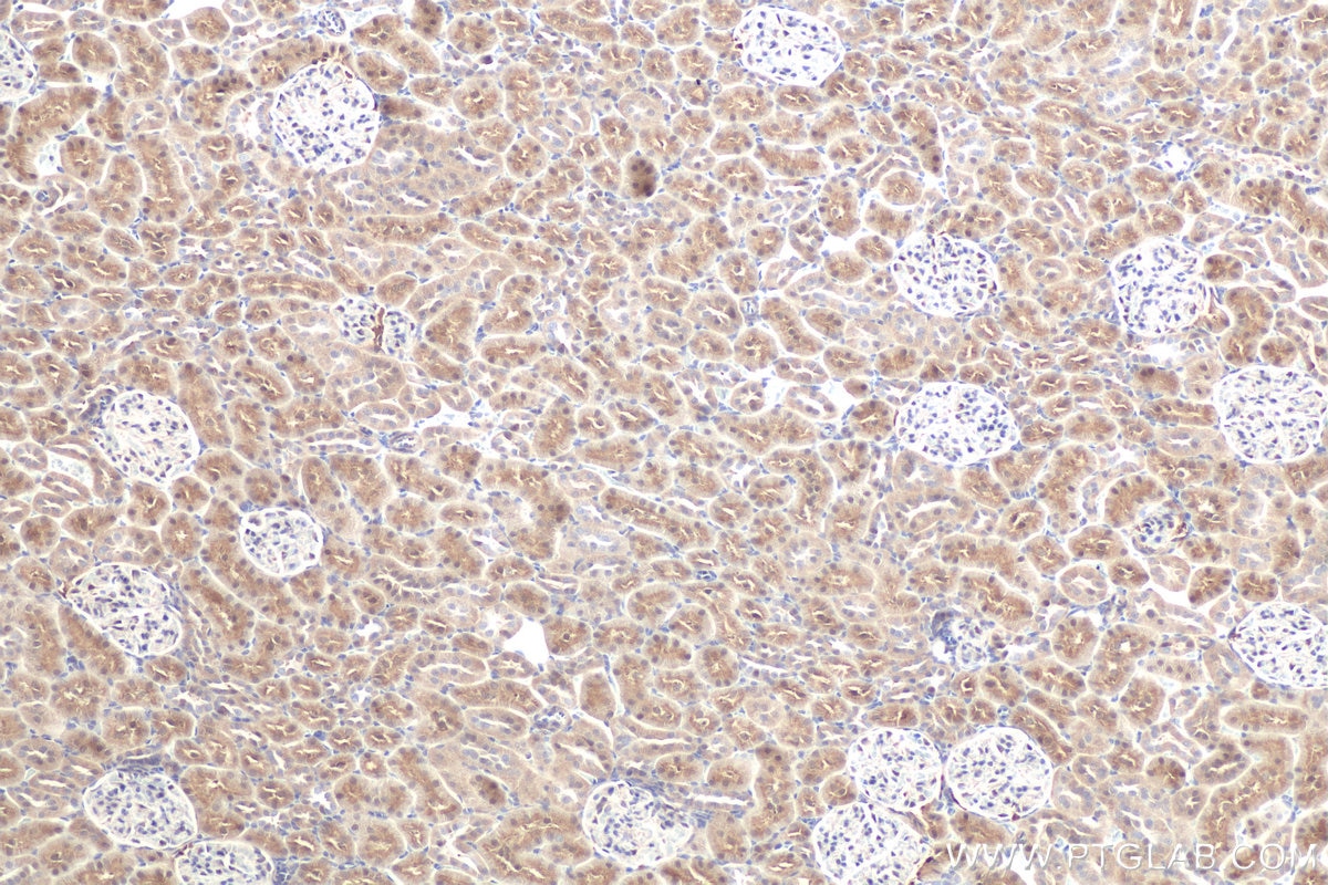 Immunohistochemistry (IHC) staining of rat kidney tissue using DOPA decarboxylase Polyclonal antibody (10166-1-AP)