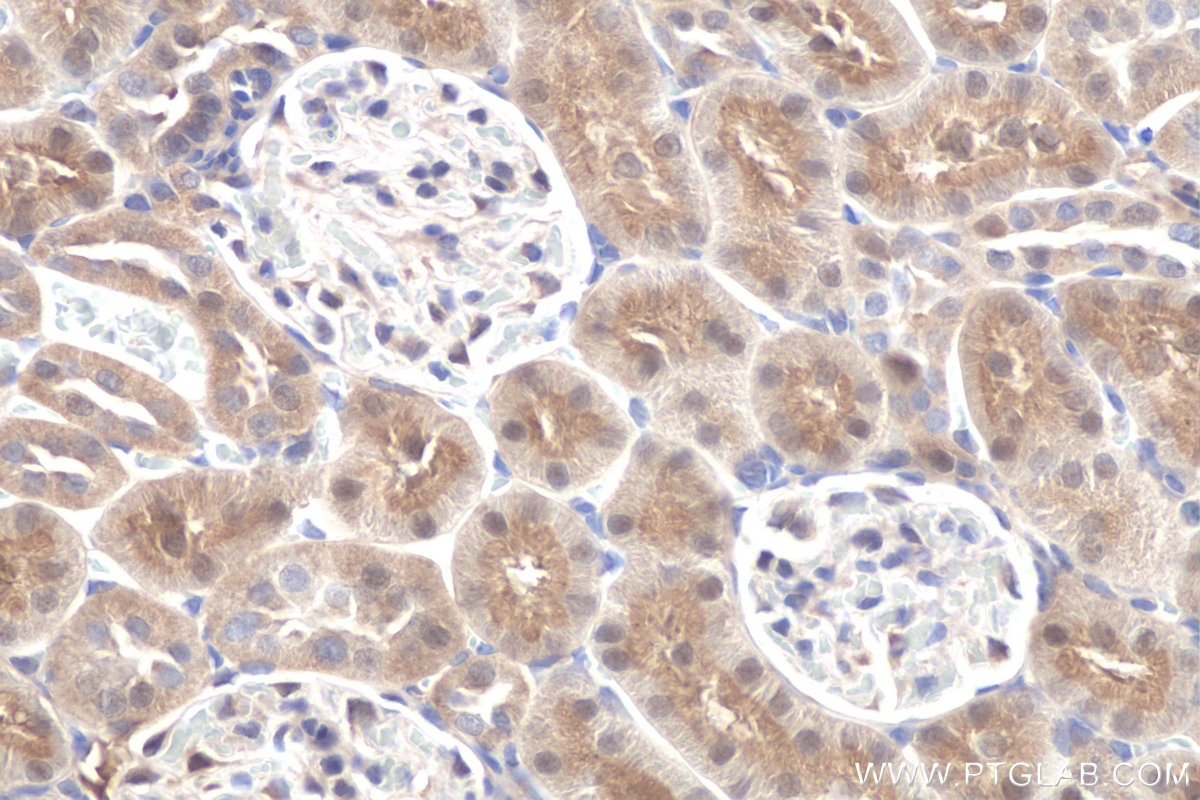 Immunohistochemistry (IHC) staining of rat kidney tissue using DOPA decarboxylase Polyclonal antibody (10166-1-AP)