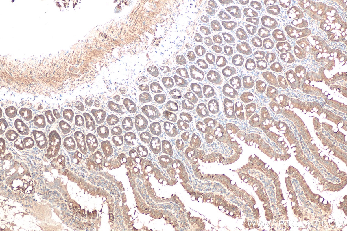Immunohistochemistry (IHC) staining of rat small intestine tissue using DOPA decarboxylase/DDC Polyclonal antibody (10166-1-AP)