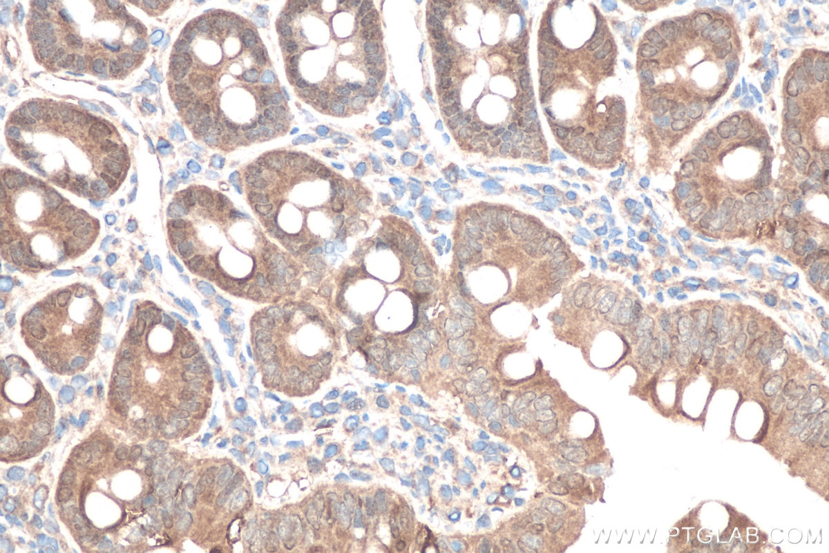 Immunohistochemistry (IHC) staining of rat small intestine tissue using DOPA decarboxylase Polyclonal antibody (10166-1-AP)