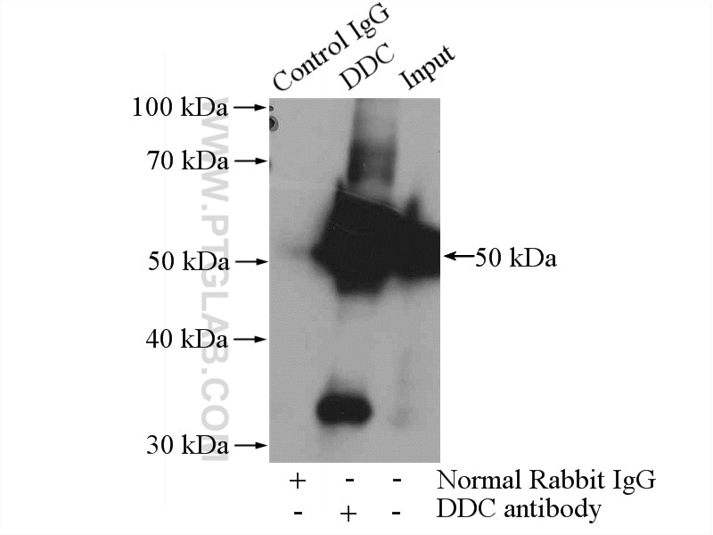 IP experiment of mouse brain using 10166-1-AP