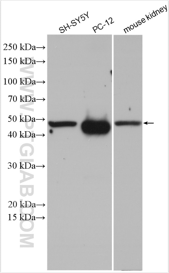 Western Blot (WB) analysis of various lysates using DOPA decarboxylase Polyclonal antibody (10166-1-AP)