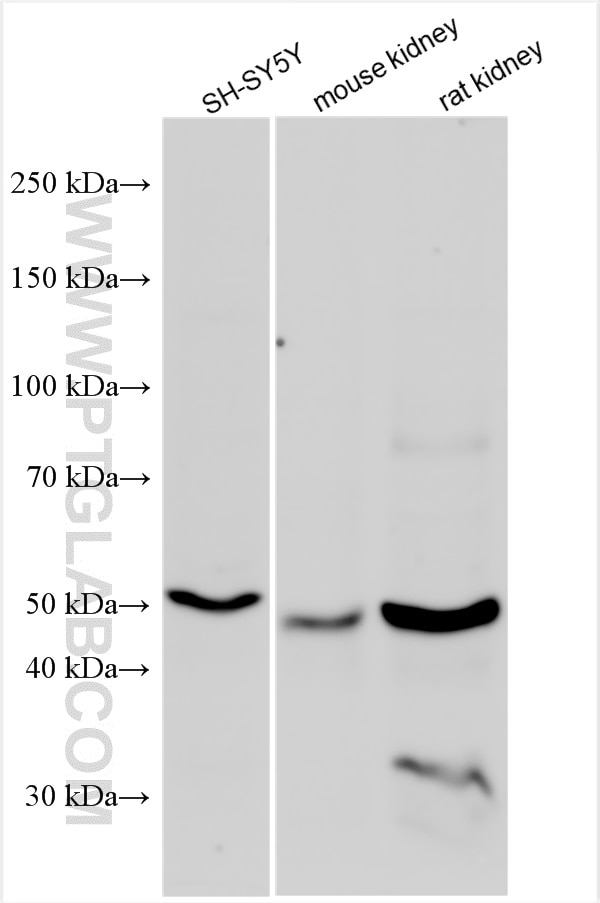 Western Blot (WB) analysis of various lysates using DOPA decarboxylase Polyclonal antibody (10166-1-AP)