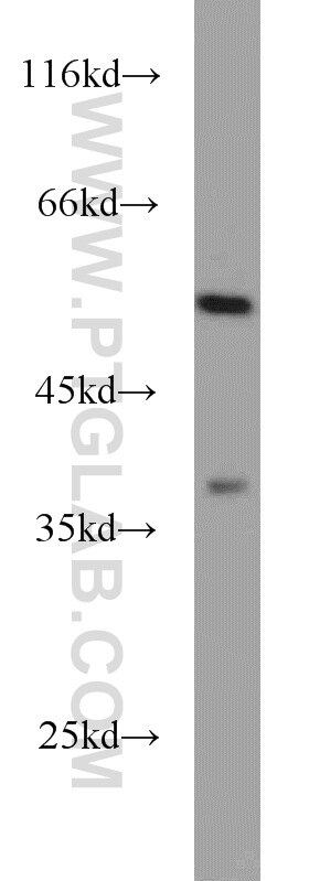 Western Blot (WB) analysis of mouse kidney tissue using DOPA decarboxylase Polyclonal antibody (10166-1-AP)