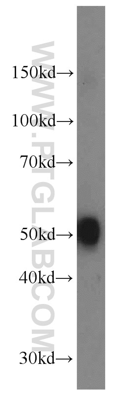 Western Blot (WB) analysis of mouse brain tissue using DOPA decarboxylase Polyclonal antibody (10166-1-AP)