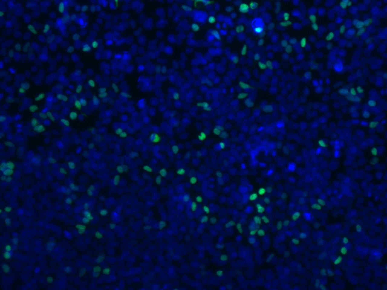 Immunofluorescence (IF) / fluorescent staining of Transfected HEK-293 cells using DYKDDDDK tag Recombinant antibody (Binds to FLAG®  (80010-1-RR)