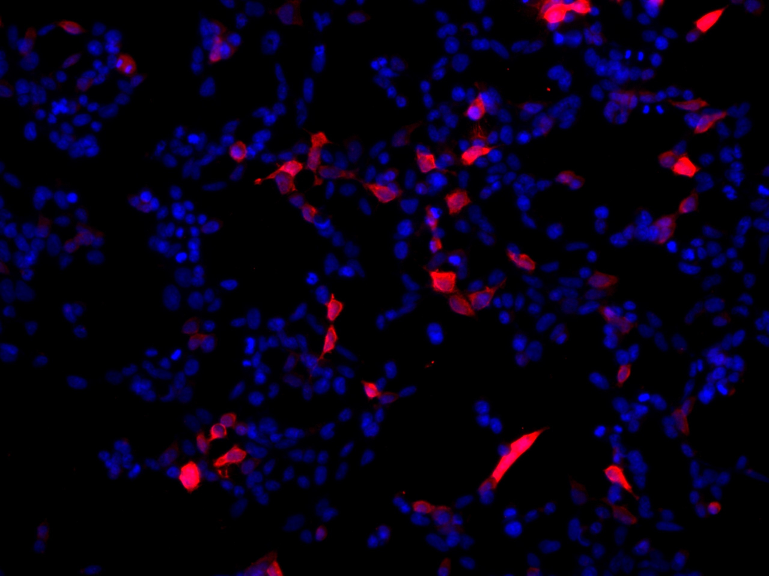 Immunofluorescence (IF) / fluorescent staining of Transfected HEK-293 cells using DYKDDDDK tag Recombinant antibody (Binds to FLAG®  (80010-1-RR)