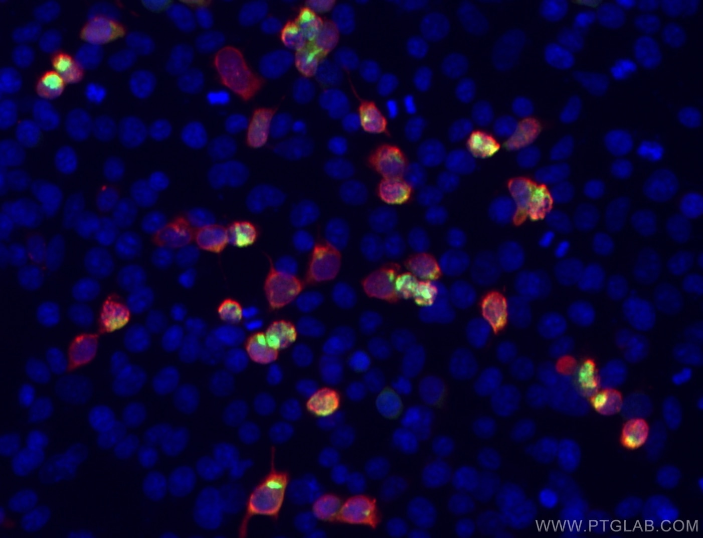 Immunofluorescence (IF) / fluorescent staining of HEK-293 cells using DYKDDDDK tag Recombinant antibody (Binds to FLAG®  (80010-1-RR)