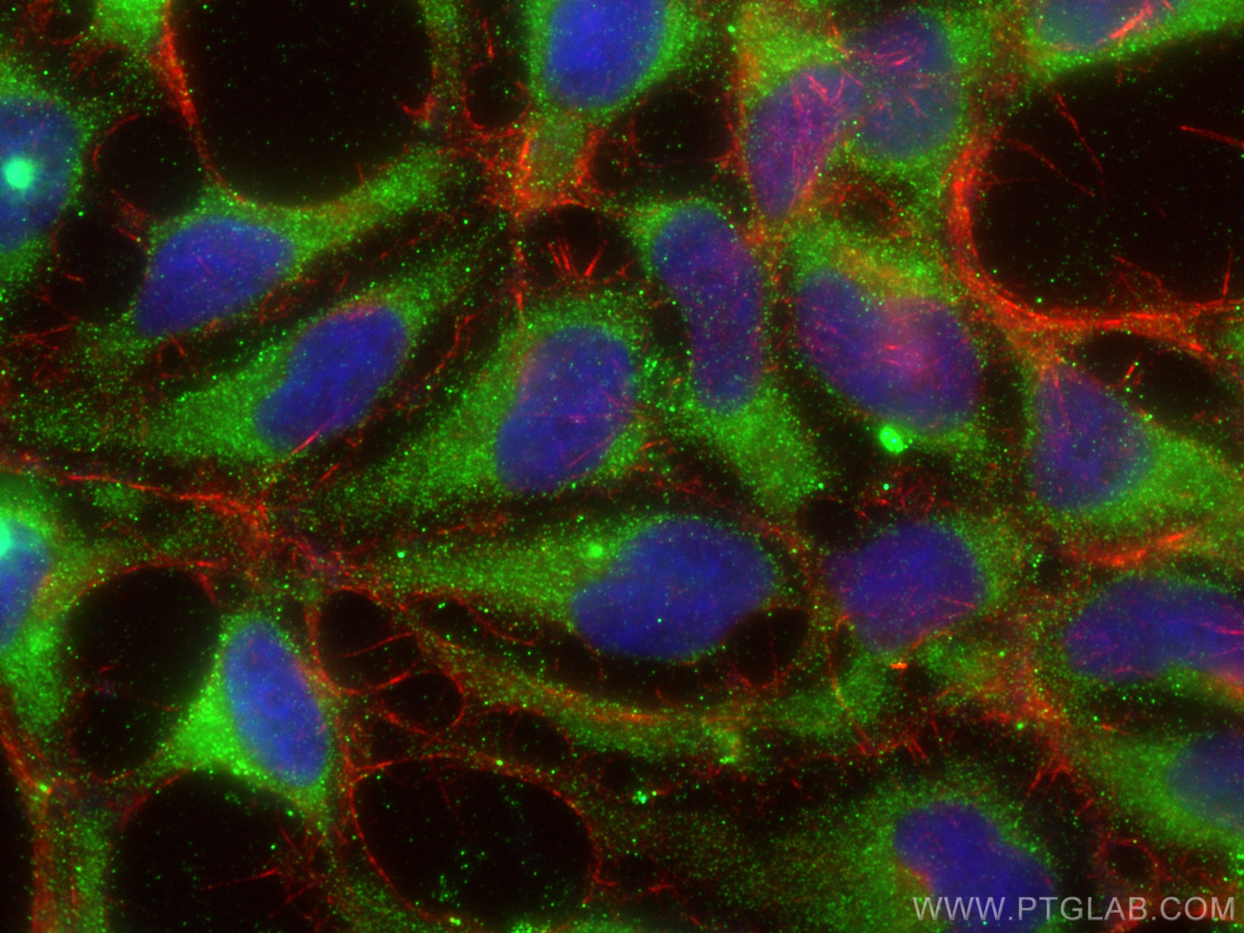 Immunofluorescence (IF) / fluorescent staining of HEK-293 cells using DDHD1 Polyclonal antibody (26297-1-AP)