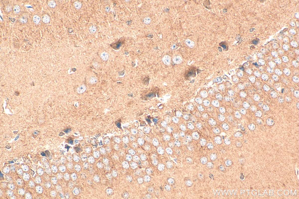 Immunohistochemistry (IHC) staining of mouse brain tissue using DDHD1 Polyclonal antibody (26297-1-AP)