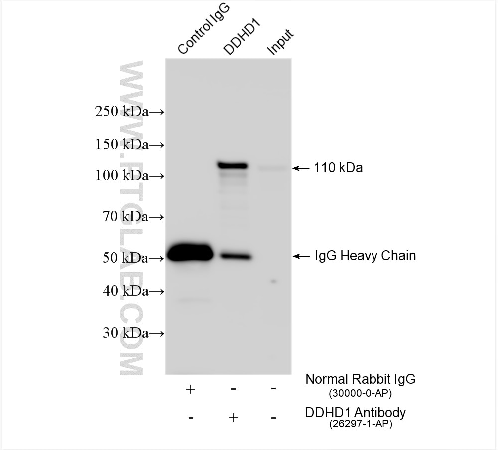 Immunoprecipitation (IP) experiment of mouse brain tissue using DDHD1 Polyclonal antibody (26297-1-AP)