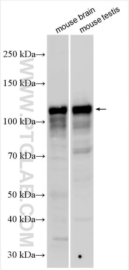 Western Blot (WB) analysis of various lysates using DDHD1 Polyclonal antibody (26297-1-AP)