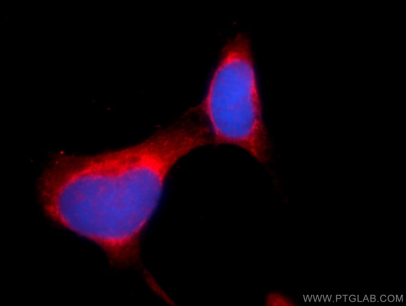 Immunofluorescence (IF) / fluorescent staining of HEK-293 cells using DDHD2 Polyclonal antibody (25203-1-AP)